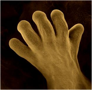 Developing Hand After Web Apoptosis