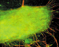 Neural Differentiation