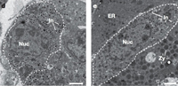 Pancreatic Cells