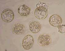 Eight Cloned Human Embryos